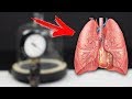 COLOQUE PULMONES AL VACIO...¿QUE PASARA?