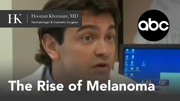 The Rise of Melanoma featuring Dr. Hooman Khorasani on ABC News