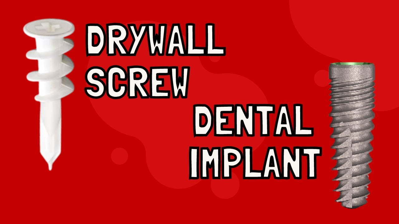 How Dental Implants are Placed Demonstration on Easy & Quick