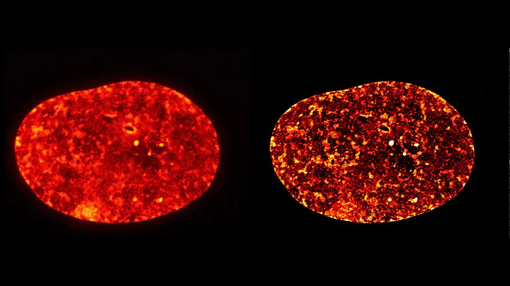 Comparison of confocal and STED images of live human fibroblast interphase nuclei