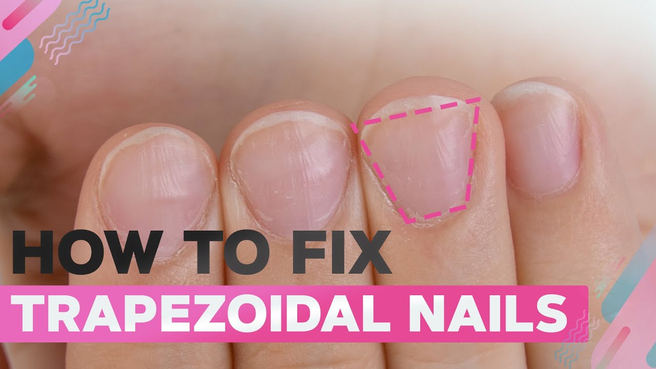 What Causes Ingrown Toenails?: The Foot & Ankle Specialists: Podiatric  Medicine