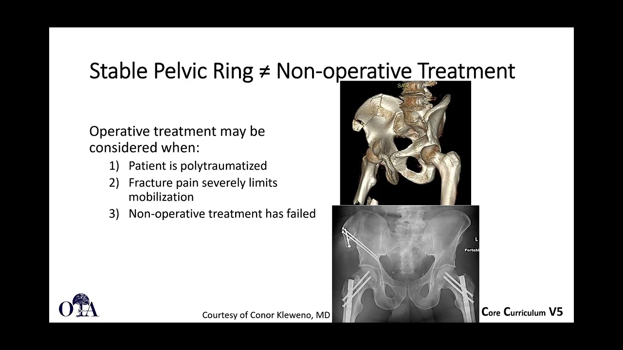 Pelvis | Musculoskeletal Key