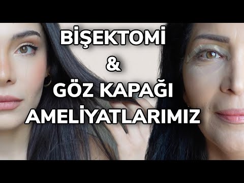 BİŞEKTOMİ & GÖZ KAPAĞI AMELİYATI TÜM SÜREÇ | ANNEMLE ESTETİK YAPTIRDIK