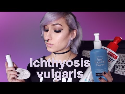 Video: Ichthyosis Vulgaris: Příčiny, Příznaky A Diagnostika