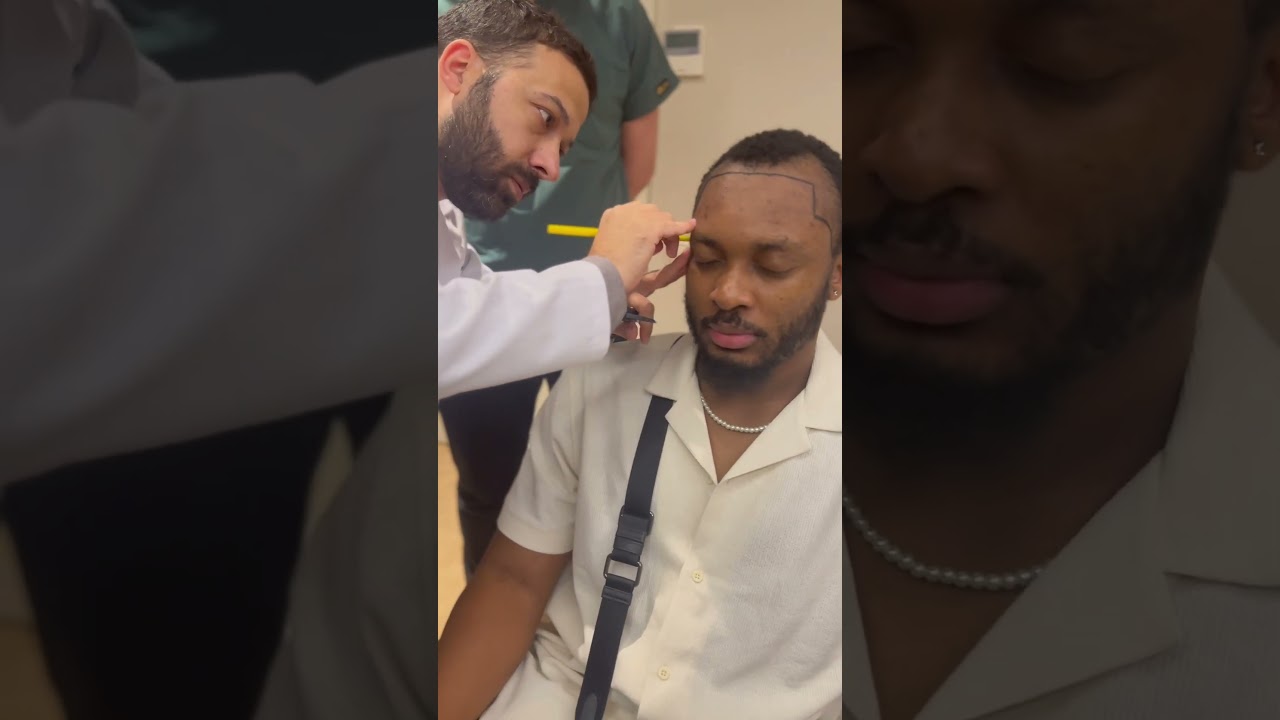 Afro Hairline Creating