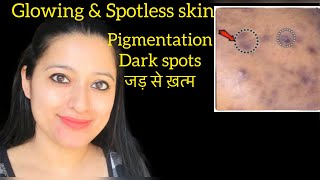 मुश्किल Remove Hyperpigmentation on Face ,  ( dark spots on face ) इस Remedy se होगा इलाज in 7 Days