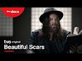Beautiful Scars Film Film TVO Original Documentary Beautiful Scars Film Film TVO Original Documentary