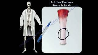 Achilles Tendon rupture, Achilles tendon stress & Strain. Thompson test.