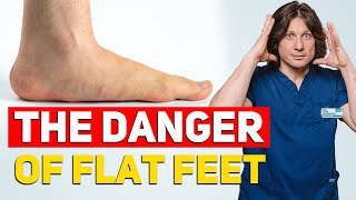 Terrible Consequences of FLAT FEET! How to Determine Flat Feet at Home?