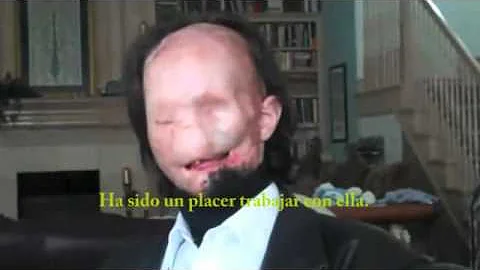 pedro bou -  warning - face transplant - transplan...