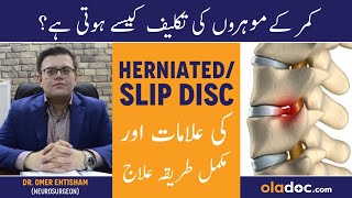 Herniated Disc Symptoms & Treatment - Mohron Ka Dard Ka Ilaj - Slipped Disc In Lower Back