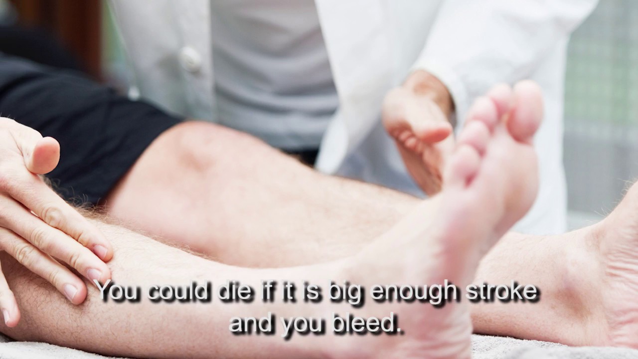 Can You Die From a Stroke? YouTube