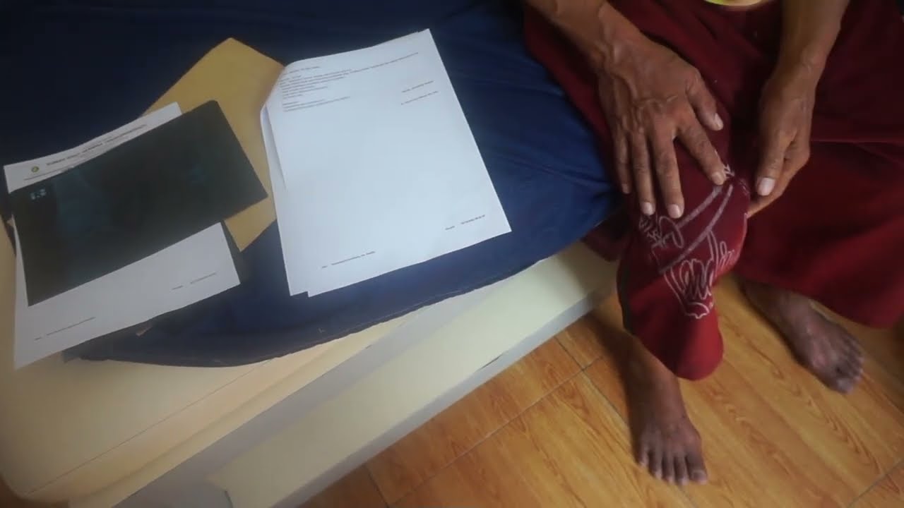 CARA MENGOBATI NYERI LUTUT, PENGAPURAN SENDI LUTUT, OSTEOARTHRITIS