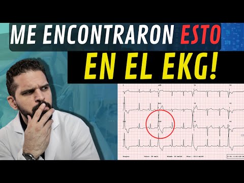 Video: ¿Un electrocardiograma mostraría arterias bloqueadas?