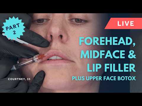 Live Forehead Filler, Lip Filler & Midface Filler Treatments Using Evidence-Based GEM©️ Techniques