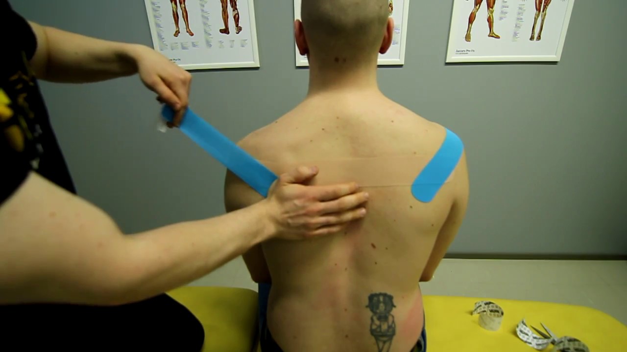 Kinesioteippaus: lavan ja hartian korjaustekniikka