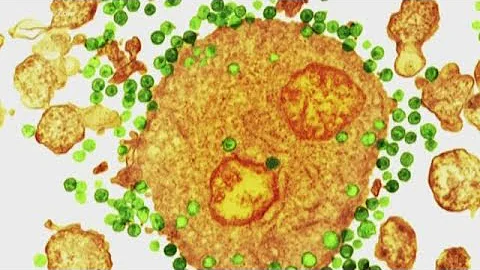 Quanto è facile contrarre l'Hiv?