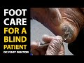 Foot Care For A Blind Patient: Treatment of Toenails, Corns, and Calluses