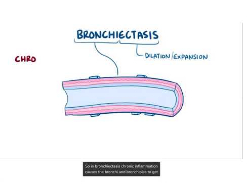 Video: Bronchiectasis - Woordenboek Van Medische Termen