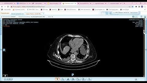 Carestream Vue Motion   Google Chrome 2022 09 09 01 55 35