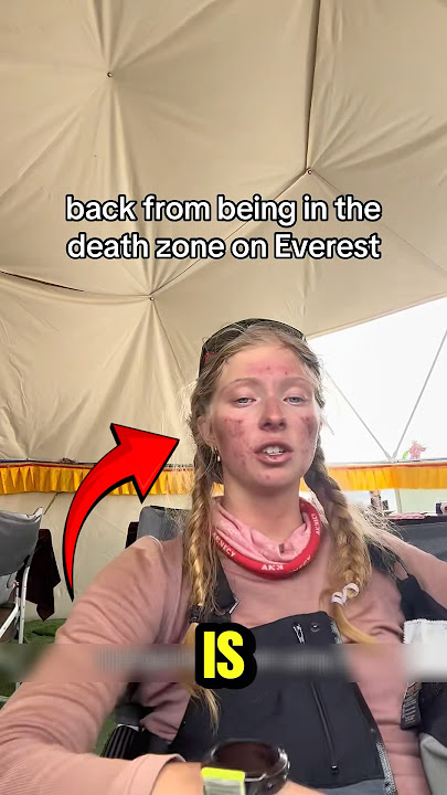 Brutal Aftermath From Climbing Mount Everest! 💔😭 #shorts