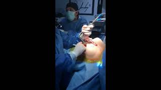 Live Streaming Plastic Surgery By Dr Jeneby Job Breast Augmentation In Austin Tx