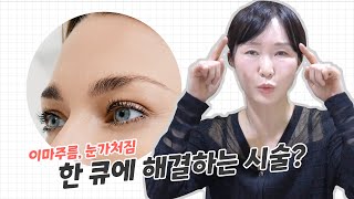 [이마리프팅] 이마 주름, 미간 주름, 이마패임, 꺼짐 이거로 끝내세요!