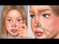 Asmr                remove unmanaged piercing pus