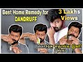 Reason For Dandruff and How to Cure it | Home Remedy | No side effects | Tamil | Shadhik