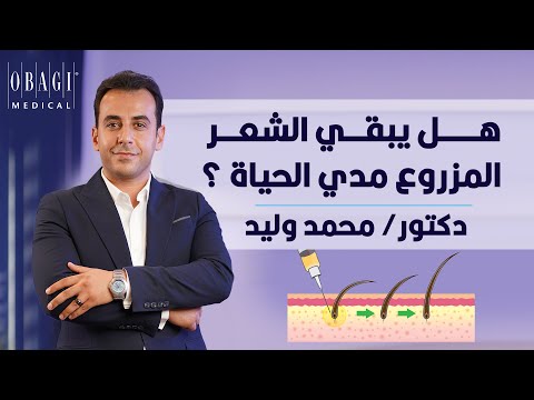 هل يبقي الشعر المزروع مدي الحياة دكتور محمد وليد