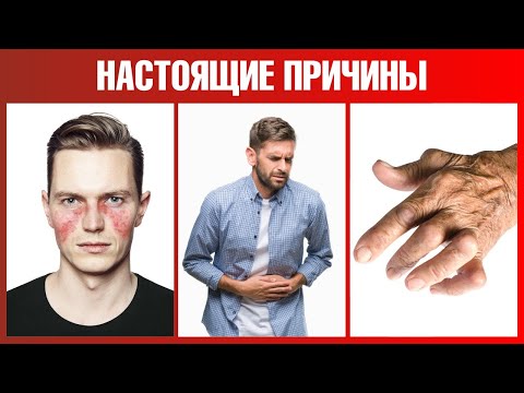 Скрытые причины воспалений: 10 причин – 10 решений🙌