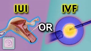 IUI vs IVF for sperm problems: 5 ways to decide