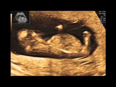 The Miracle of Birth