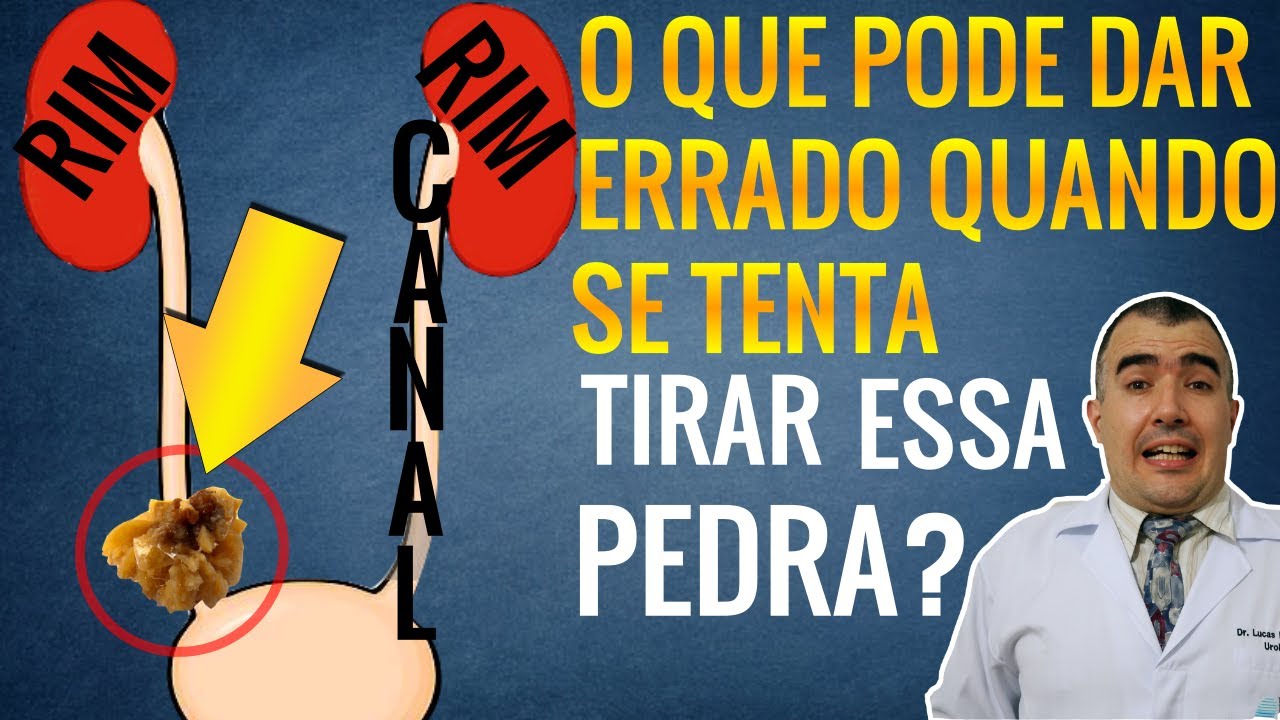 Complicações da cirurgia de retirada de pedras no... - youtube