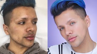 Morning Skin Care Routine for Oily & Problematic Skin | Gabriel Zamora