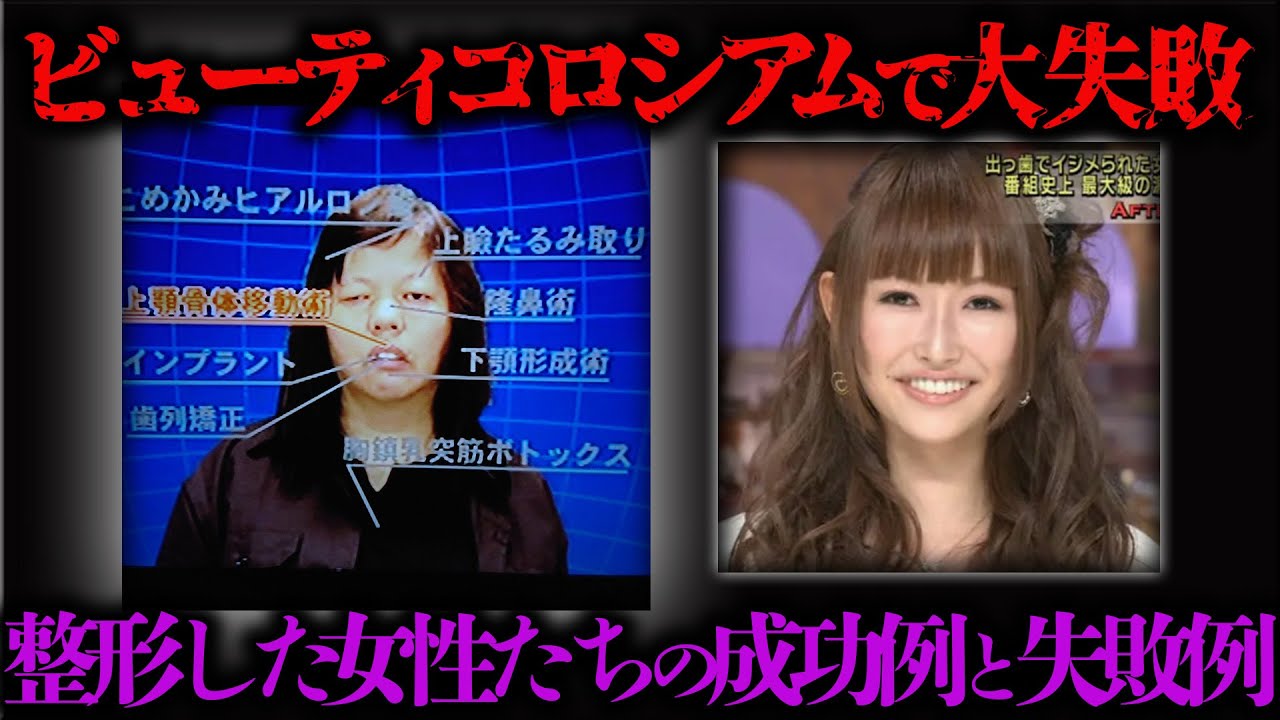 【衝撃】ビューティーコロシアムで整形した女性たちがヤバ過ぎる