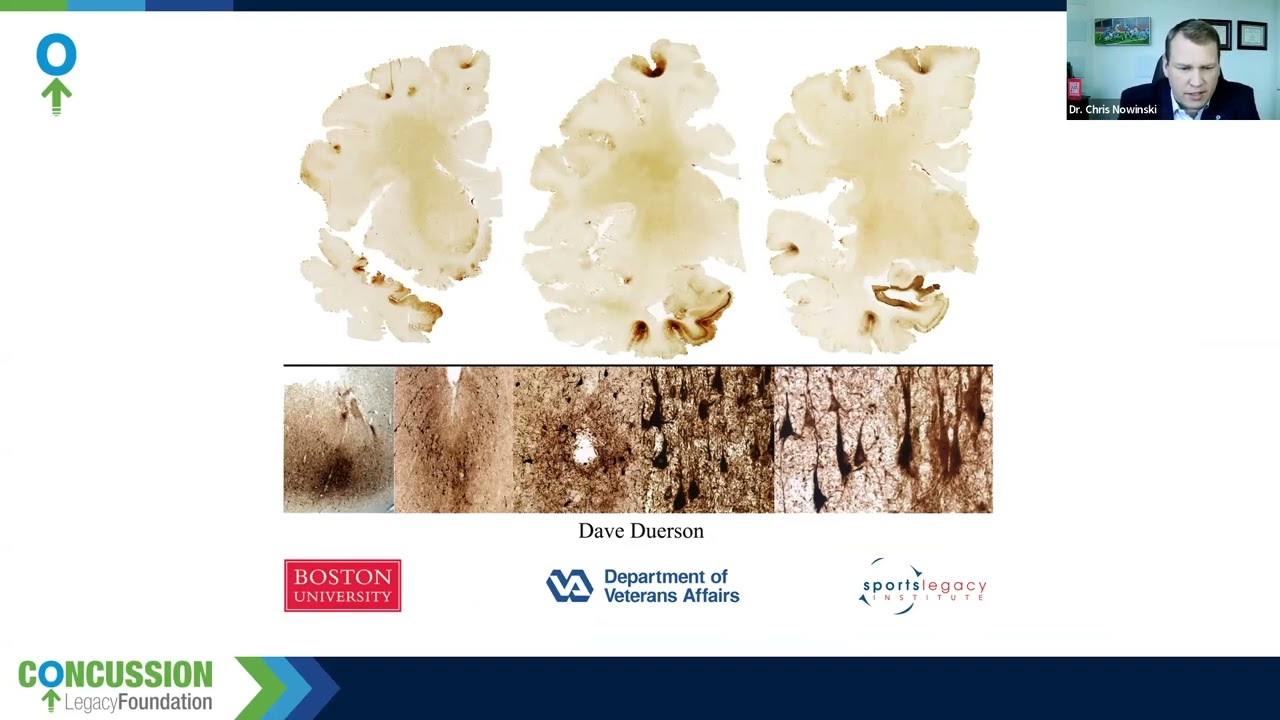 Prioritizing CTE Research for Military Veterans