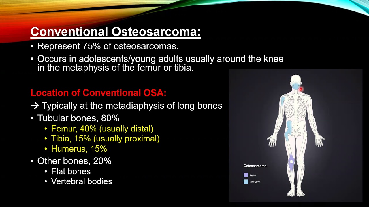 Osteolytic bone tumors  ill defined