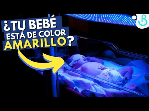 Video: 3 formas sencillas de tratar la ictericia en los bebés