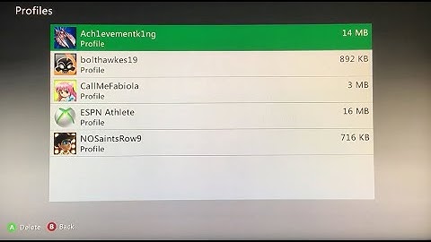 How to delete Xbox 360 Accounts on Xbox One
