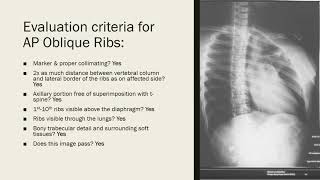 Oblique Ribs for RADS 4510