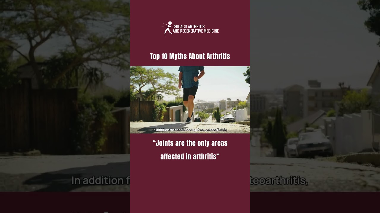 Joints are the only areas affected in arthritis. ❌ 