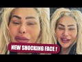 Darcey Silva Gets Massive Backlash After Her New Face Being Revealed