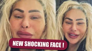 Darcey Silva Gets Massive Backlash After Her New Face Being Revealed