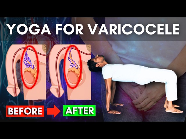 Varicocele Exercises Part 1, At Home