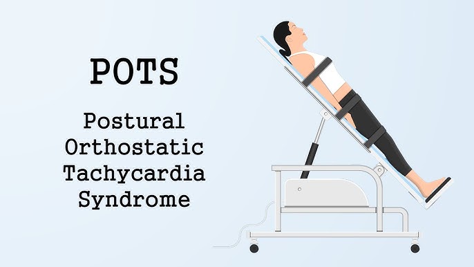 SPOT (Síndrome da Taquicardia Postural Ortostática) 