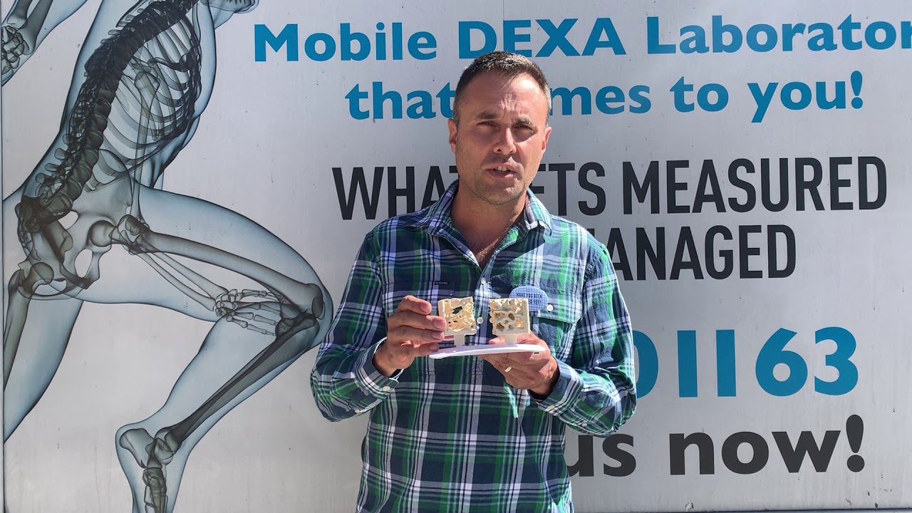 Dr Quinten Bone Density Screening YouTube