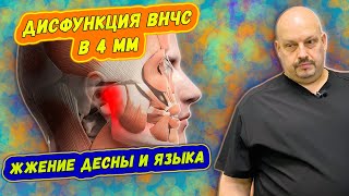 Дисфункция ВНЧС в 4 мм | Нарушение прикуса | Жжение десны и языка |  Онемение уха | Ответ на вопрос