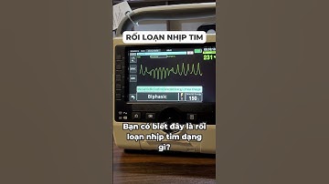 Rối loạn nhịp tim dạng xoắn đỉnh hay Torsades de Pointes