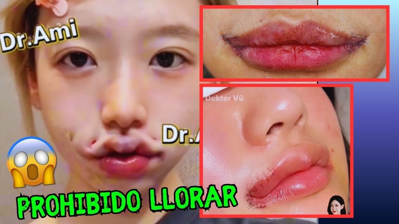 La Mentira Del K-Pop: El Oscuro Secreto De Las Caras 